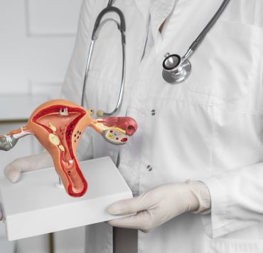 cáncer de cuello uterino